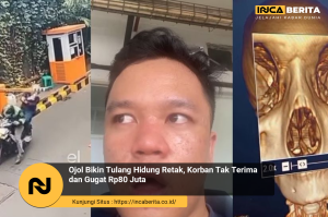 Tulang Hidung Retak Gegara Ojol, Korban Tuntut Rp80 Juta:
