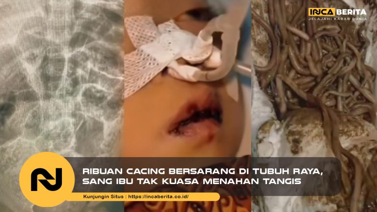 Ribuan Cacing Bersarang di Tubuh Raya, Sang Ibu Tak Kuasa Menahan Tangis